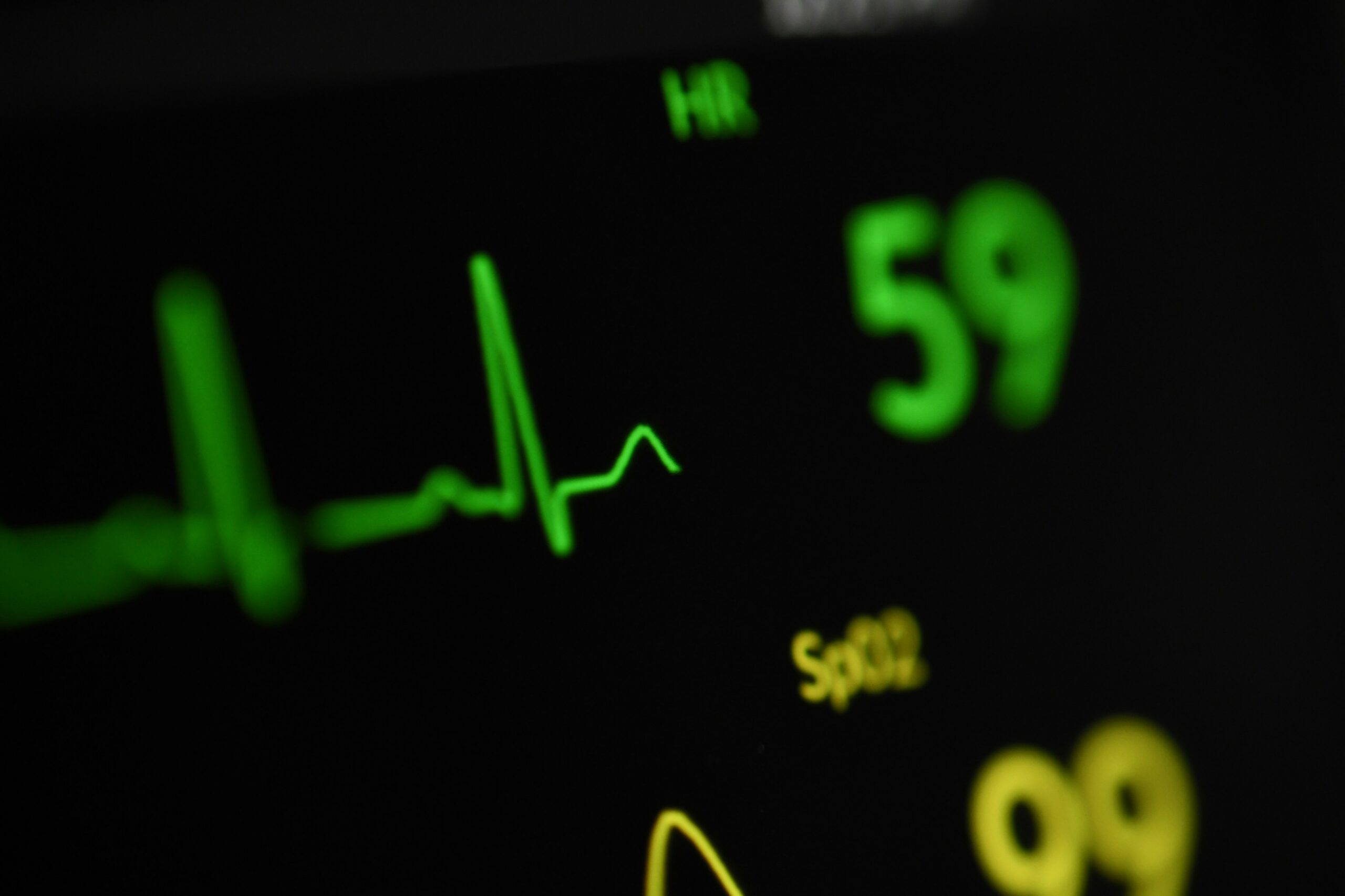 With AI, researchers discover new way to detect sudden cardiac death risk